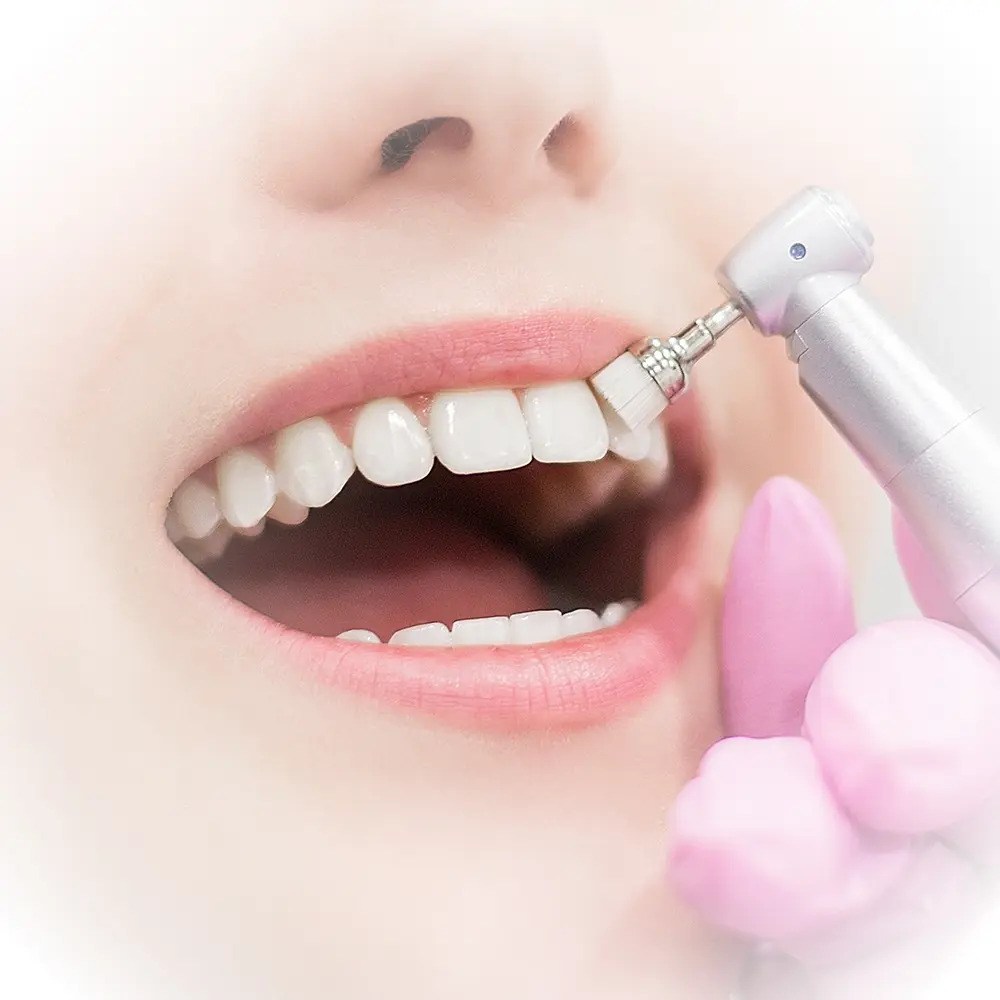 Dental scaling and teeth polishing procedure
