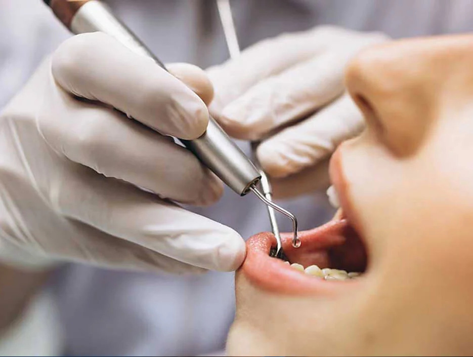 Endodontic root canal therapy procedure