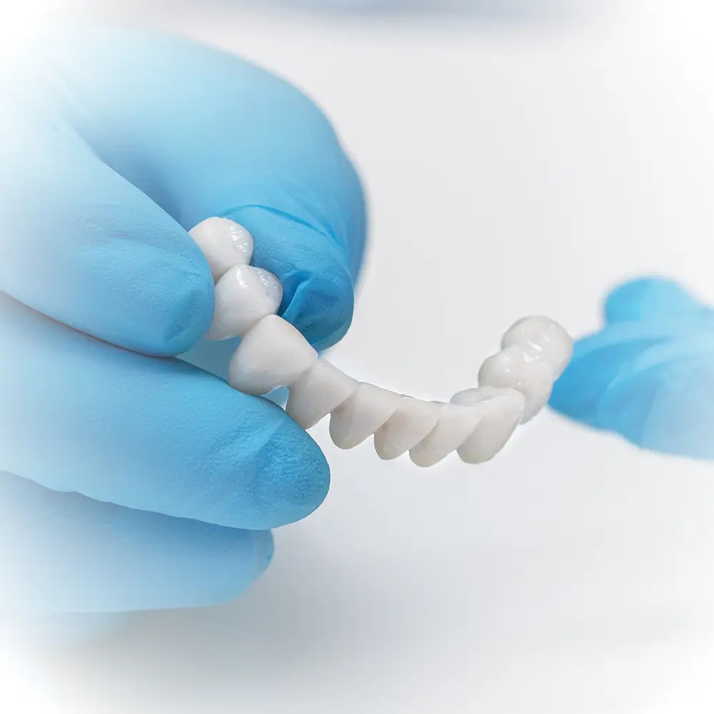 Metal-free Zirconia dental crown placement